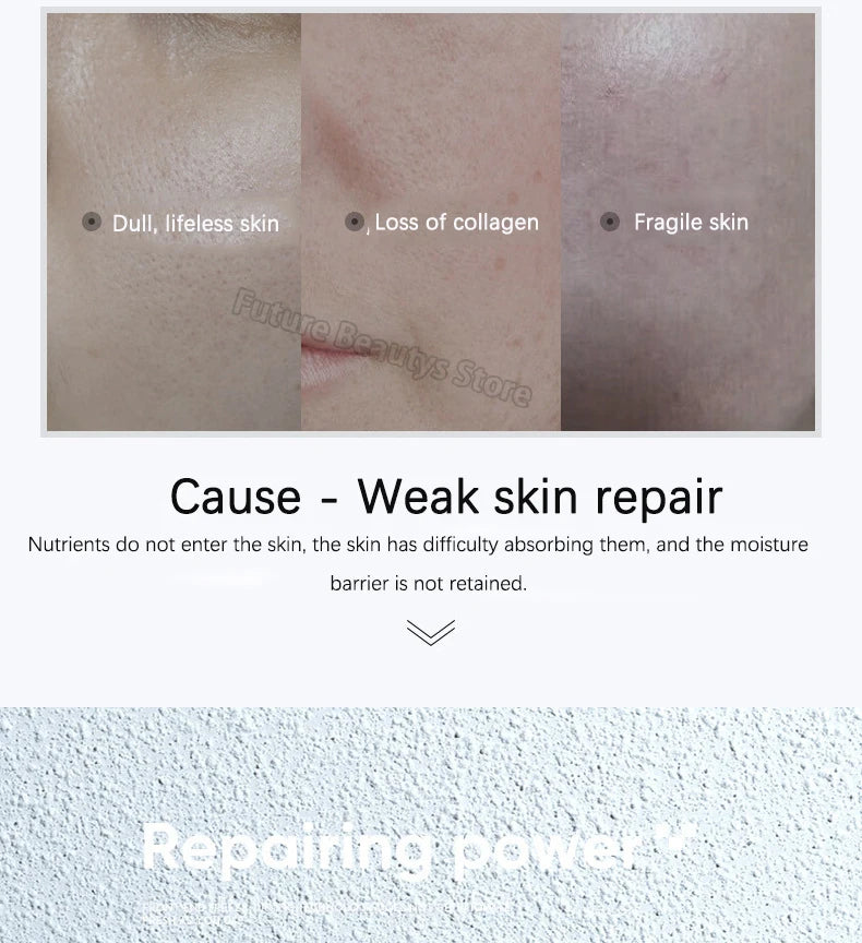 Korea Face Hyaluronic Acid Fibronectin Freeze Dried Powder Repair Sensitive Skin Firming Moisturising Skin Rejuvenat Skin Care