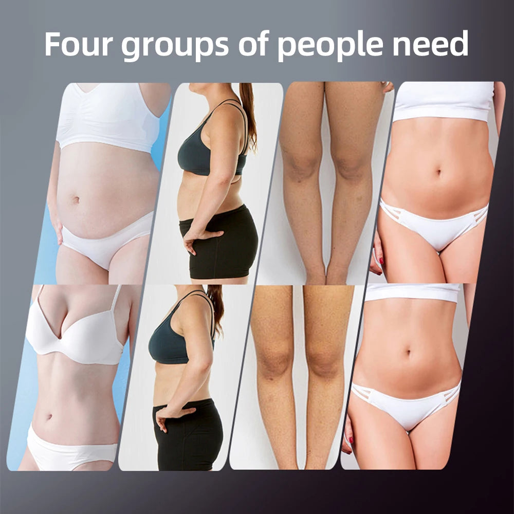 4 in 1 Electric Body Slimming Massager Cellulite Remover EMS RF Radio Frequency Body Sculpting Machine Weight Loss Cordless