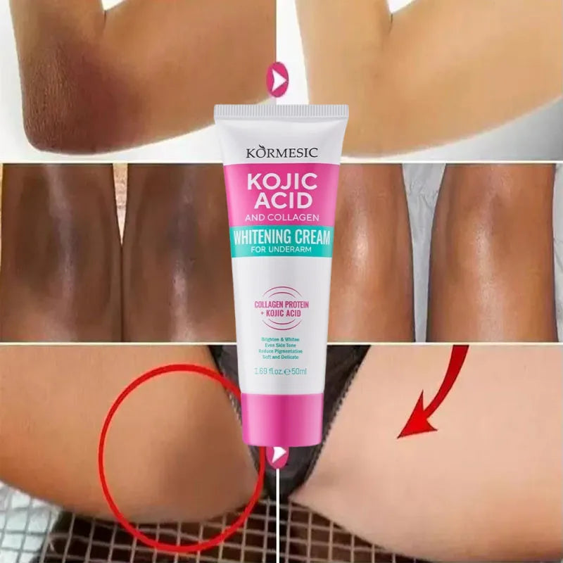 Whitening Cream Private Parts Underarm Bleaching Serum Whiten Butt Knee Brighten Inner Thigh Intimate Parts Dark Remove Melanin