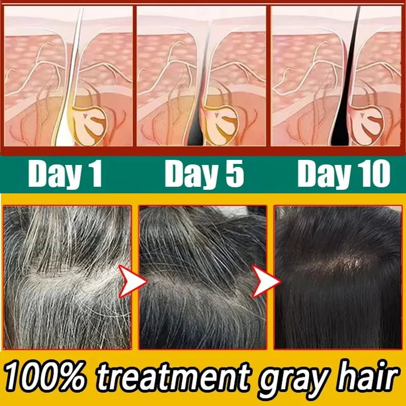 Herbal Anti-grey Hair Treatment Serum Cream White To Black Permanent Repair Natural Color Nourish Scalp Hair Care Products