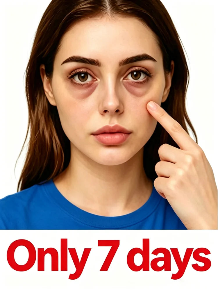 2026 New Upgraded Bestselling Eye Care Tool - Eye Revitalizing Ointment (Free Shipping)