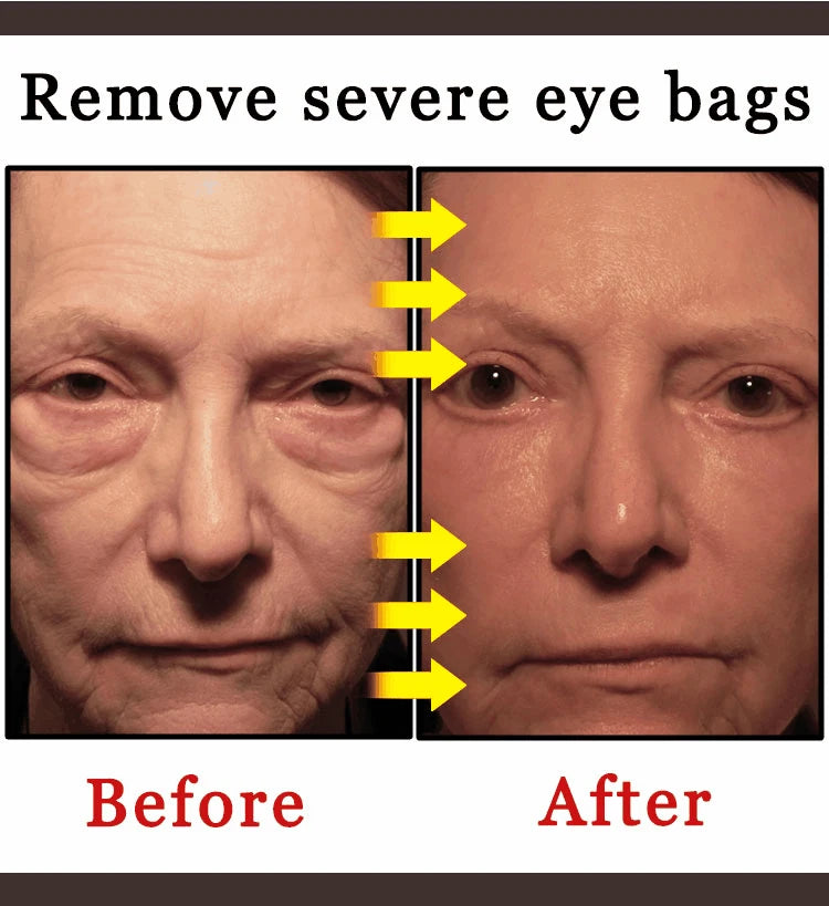 2026 Bestselling Eye Care Tool - Eye Revitalizing Cream (Free Shipping)