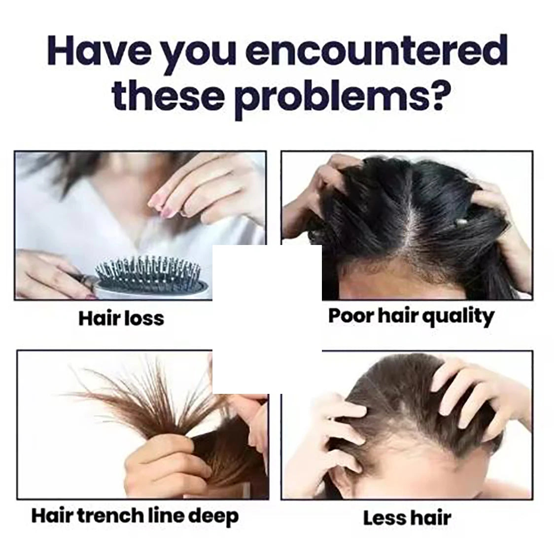It strengthens hair and promotes hair growth simultaneously, resulting in strong, resilient hair that is not easily broken.