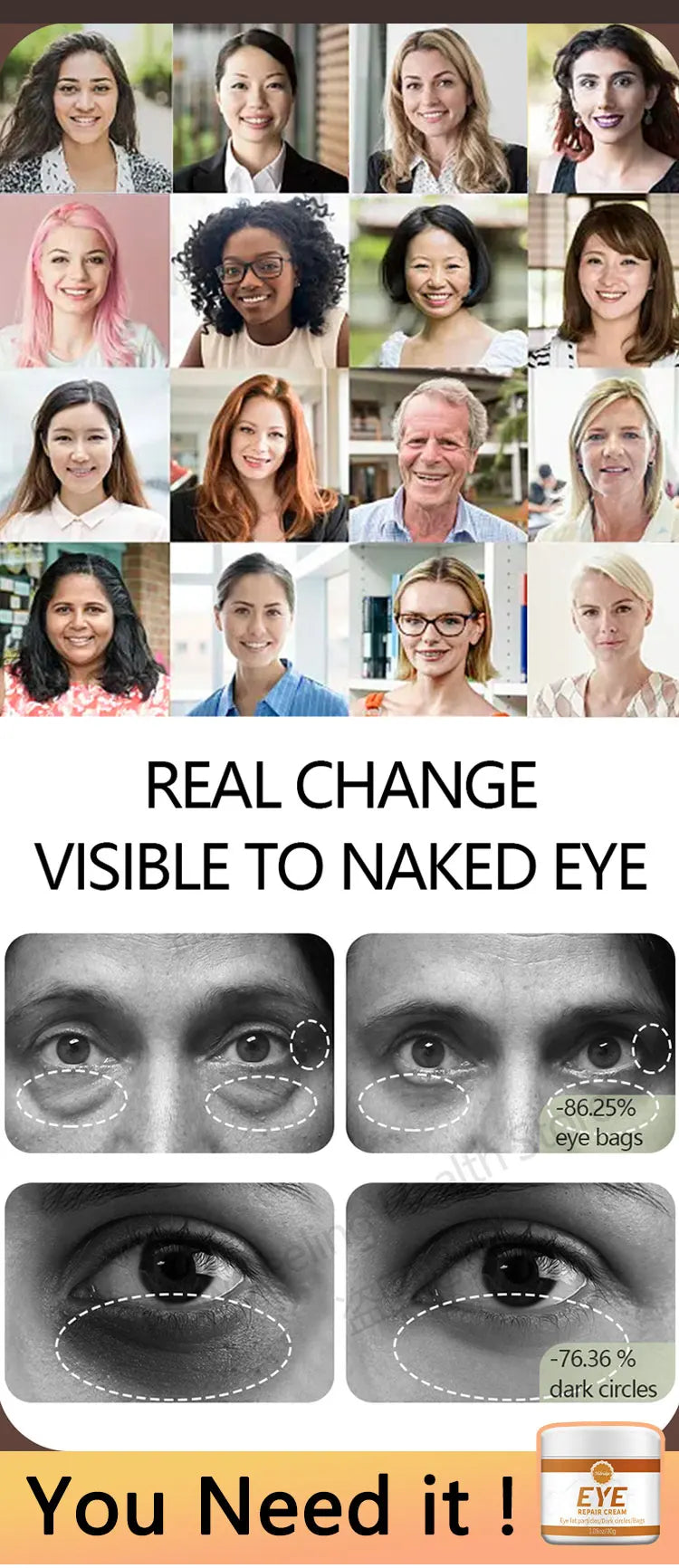 2026 New Upgraded Bestselling Eye Care Tool - Eye Revitalizing Ointment (Free Shipping)
