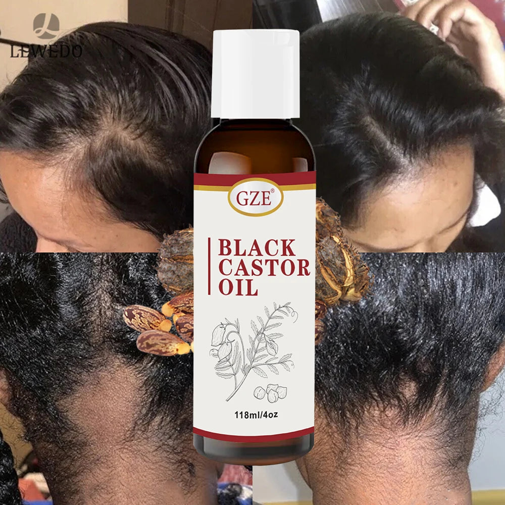 Jamaican Black Castor Oil for Hair Strengthens & Thickens | Body Care - Roasted & Cold-Pressed - Body Massage Oil for Hair