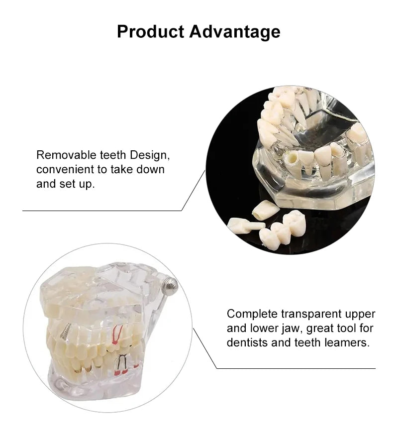 VVDental Teeth Repair Model Disease Teeth Model for Dentist Student Practice Training Studying Oral Medical Dentistry Tools