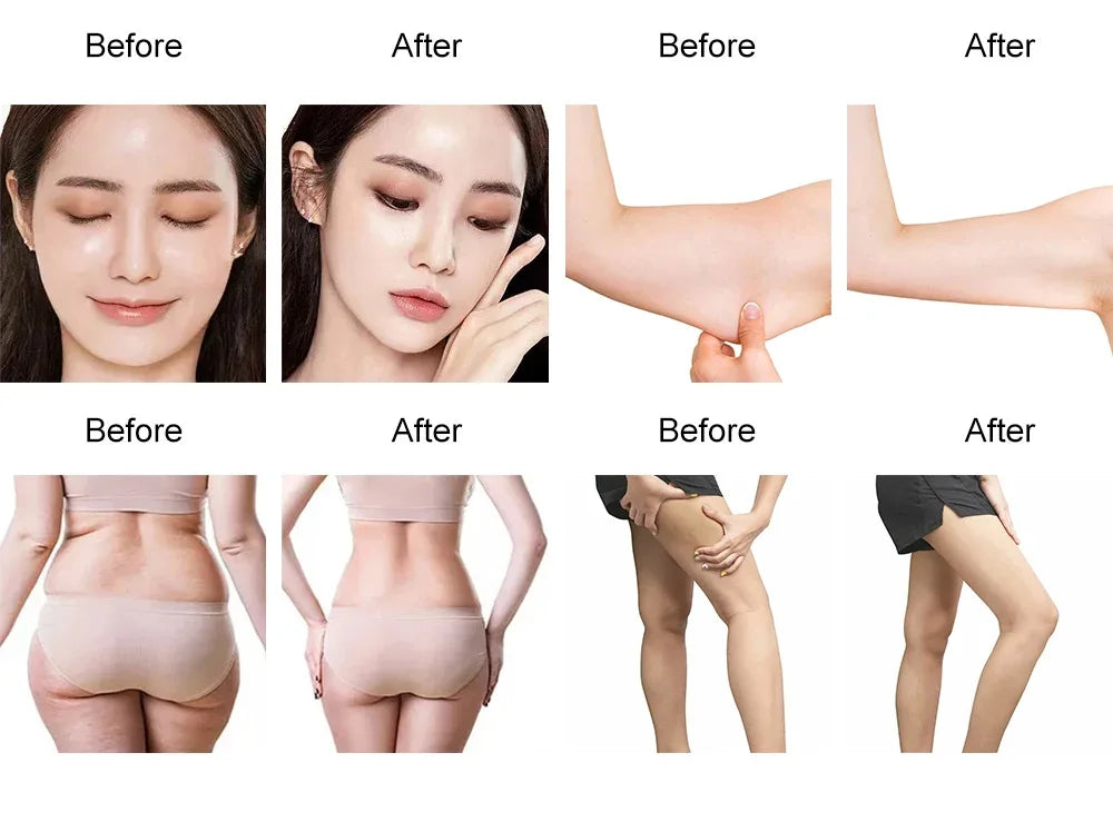 G5 Vibration Slimming Machine High Frequency Massager Fat Burning Body Shaping Vibrate Massage Anti Cellulite With 5 Tips Device