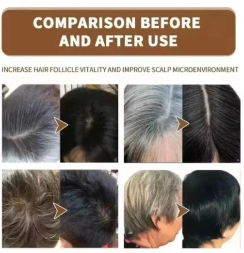 Scalp Care Black Essence Nourishes Hair Balances Oil Unclogs Follicles Boosts Shine