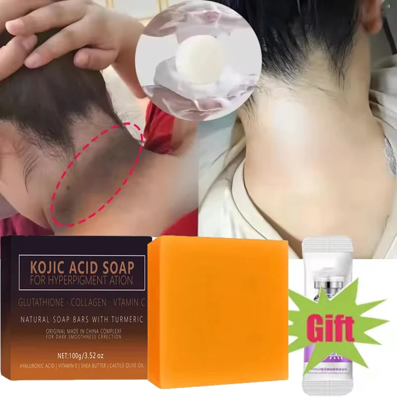 Kojic Acid Dark Spot Remover Whitening Soap Handmade Skin Care Deep Cleaning Moisturizing Cleansing Essential Soap Brighten Skin