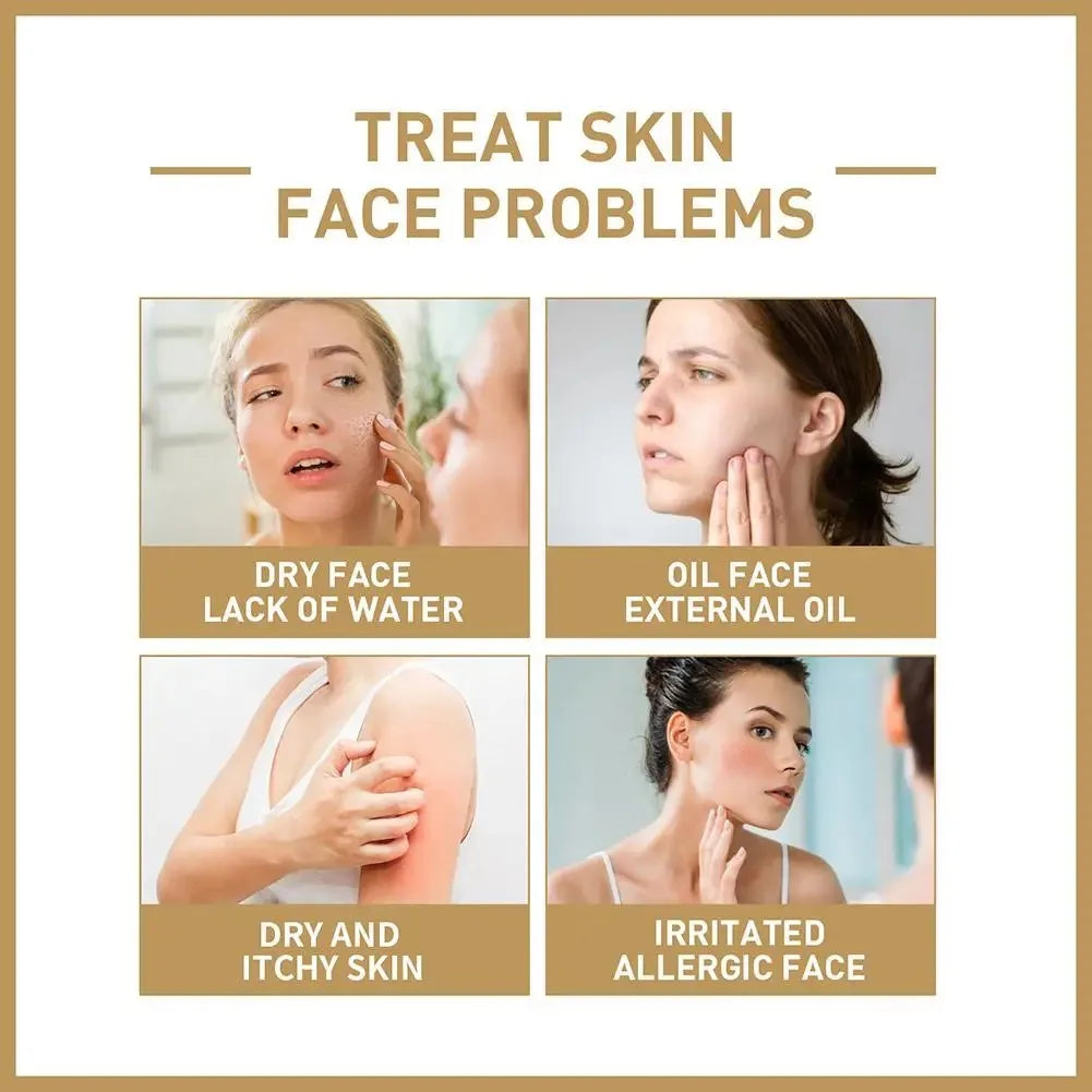EELHOE Rice Face Toner Moisturizing Water Brightening Lifting 150ml Deep Facial Cleanser for Young Glowy Korean Skin Care