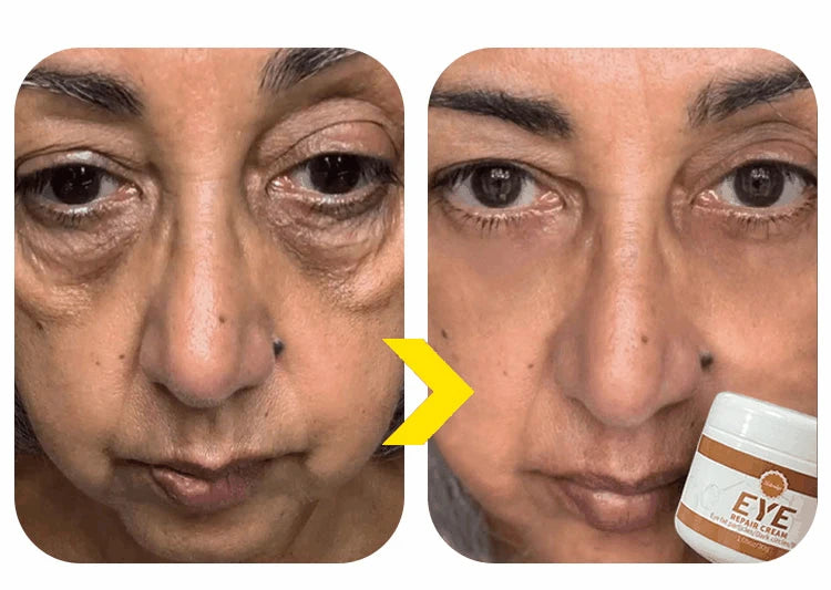 2026 New Upgraded Bestselling Eye Care Tool - Eye Revitalizing Ointment (Free Shipping)
