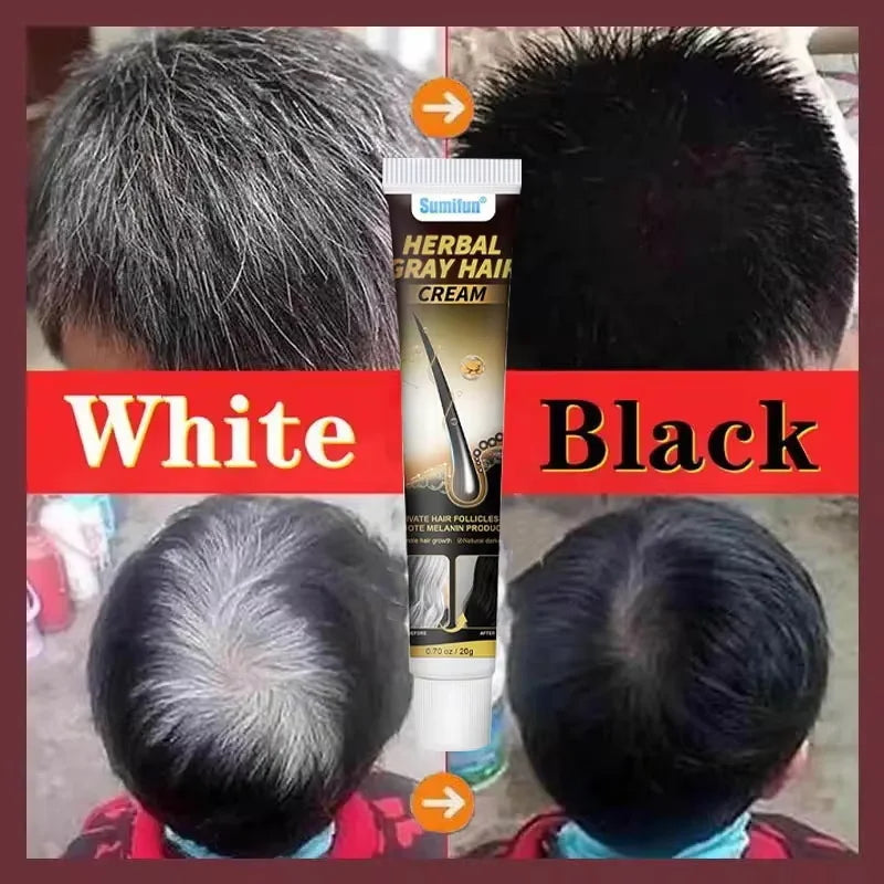 Herbal Anti-grey Hair Treatment Serum Cream White To Black Permanent Repair Natural Color Nourish Scalp Hair Care Products