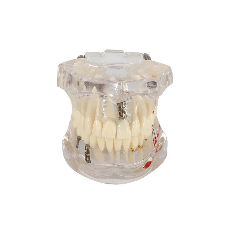VVDental Teeth Repair Model Disease Teeth Model for Dentist Student Practice Training Studying Oral Medical Dentistry Tools