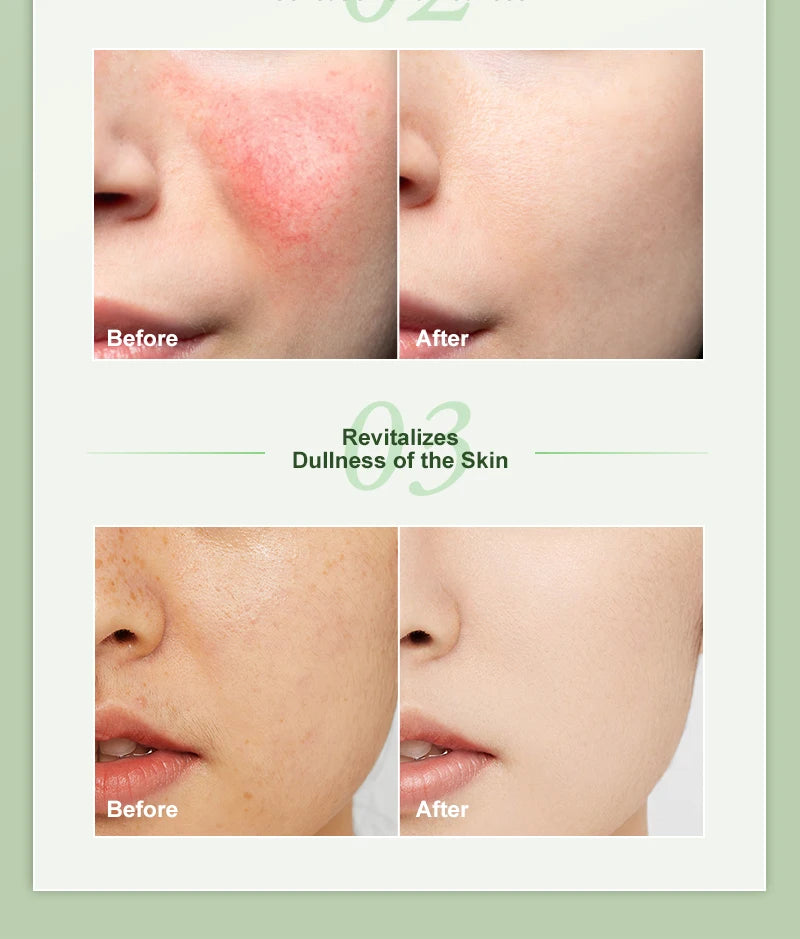 AUQUEST Niacinamide Face Cream Whitening  Moisturizing Hyaluronic Acid Smoothing Brightening Facial Cream Skin Care