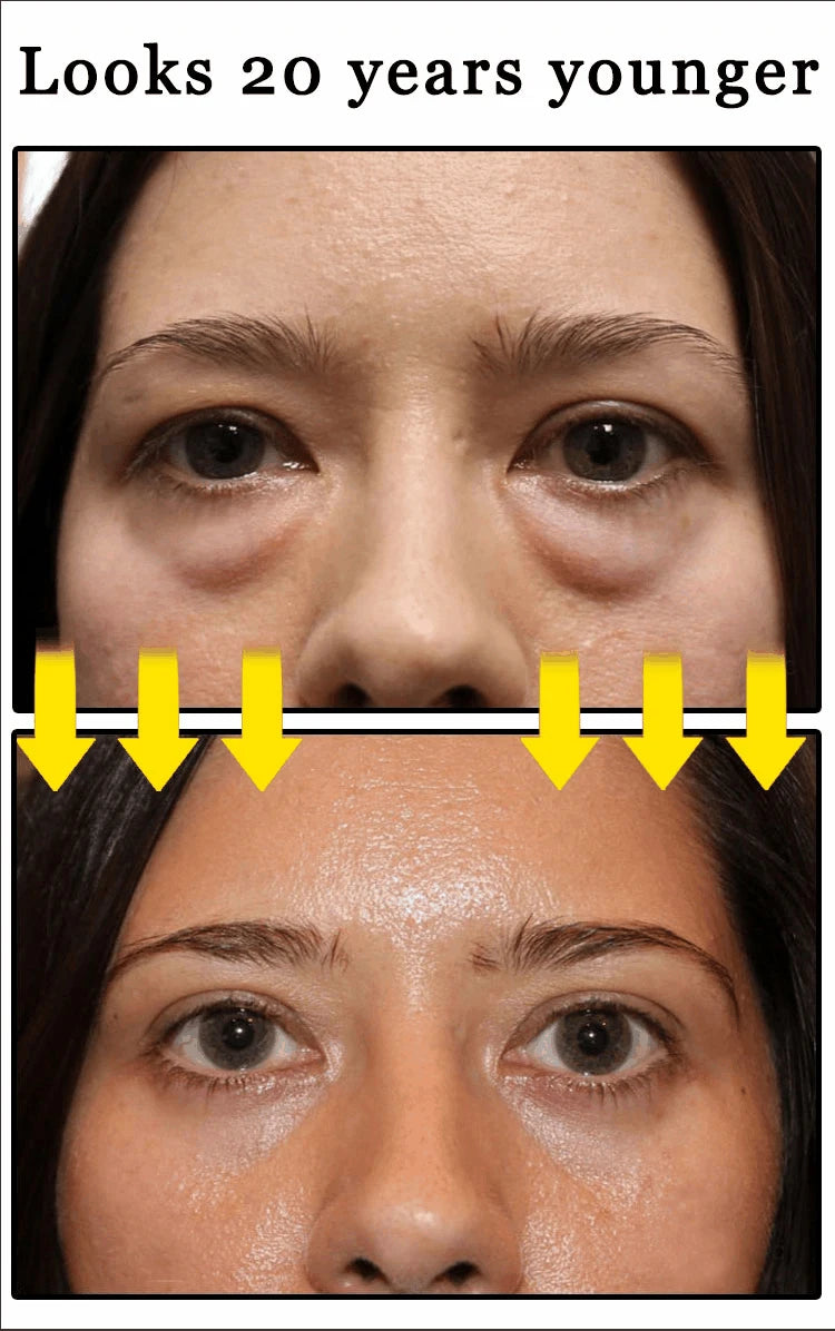 2026 Bestselling Eye Care Tool - Eye Revitalizing Cream (Free Shipping)