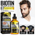 Biotin Hair Oil Collagen Scalp Serum Strengthening Treatment Natural Rosemary Ginseng Extract Thicker Hair Care Essential Oil