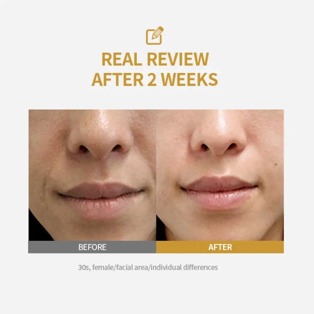 Deep Collagen Silk Peptide Intensive Lifting Ampoule Korean Anti-Aging Serum for Face with Collagen Skin Tightening & Firming