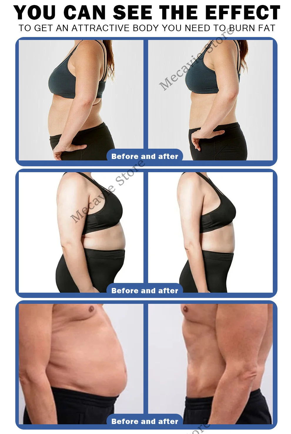New Profession EMS 15 T RF Professional Body Shaper 6500W Muscle Stimulator Newest EMS Machine for Fitness And Wellness