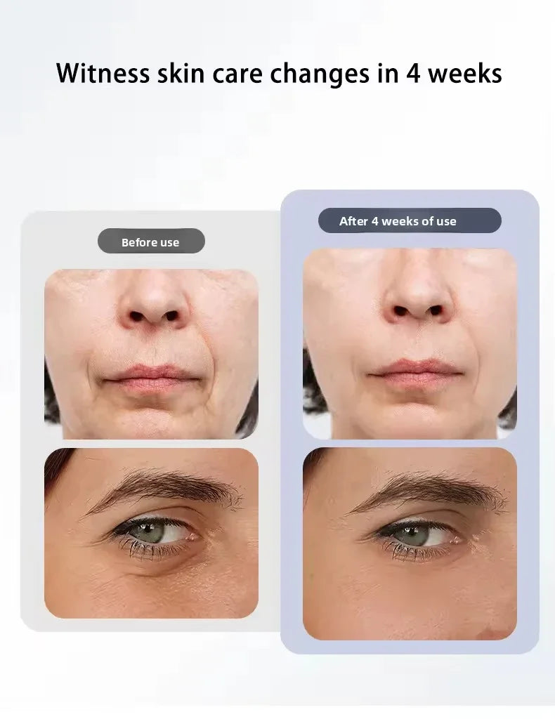 3 Gears Face Lifting Device Face Massager Eye Beauty Instrument Home Use EMS Microcurrent Facial Toning Device