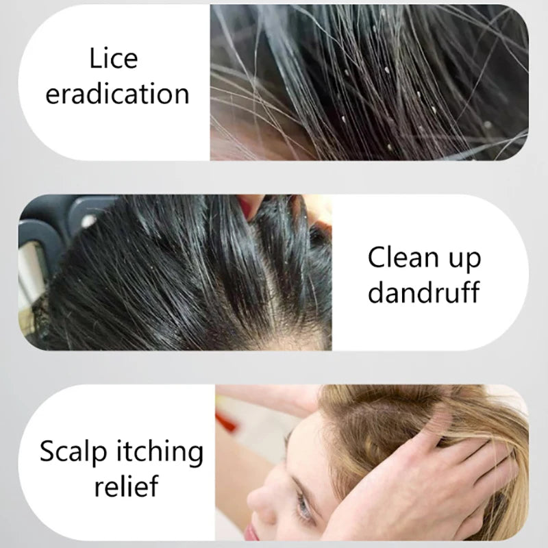 Double Sided Lice Comb Ultra-Dense Fine Tooth Scalp Massage Flea Removal Comb For Children Pet Grooming Tool