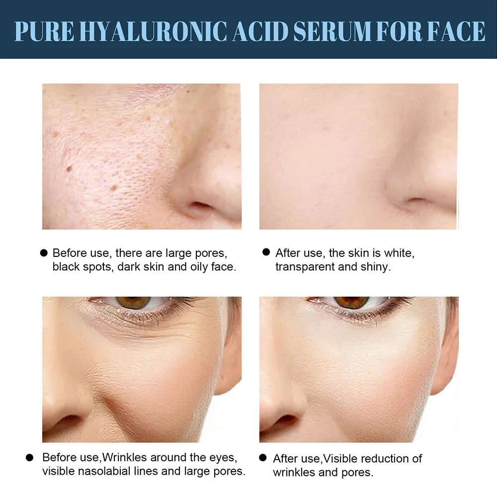 60pcs Gold Protein Line Anti-Wrinkle Firming Facial Filler No Needle Absorbable Fade Fine Lines Collagen Thread Anti-Aging Serum