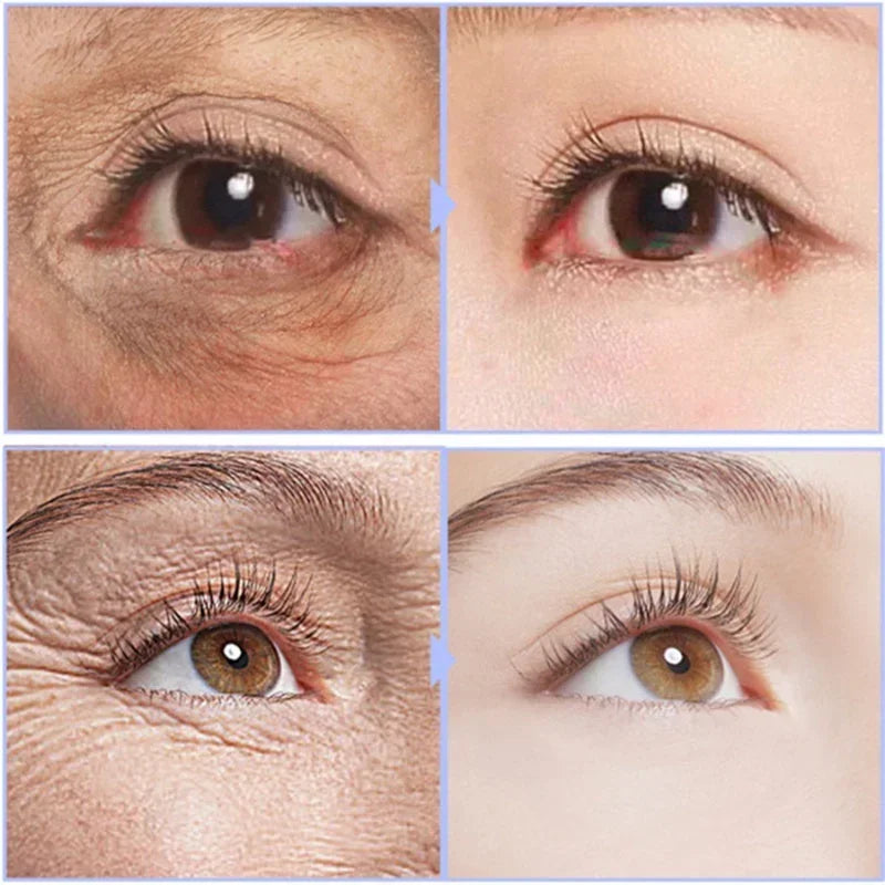 Instant Eye Bag Removal Rolling Beads Massage Serum Retinol Anti-Wrinkle Firm Skin Anti Dark Circle Puffiness Brighten Eye Care