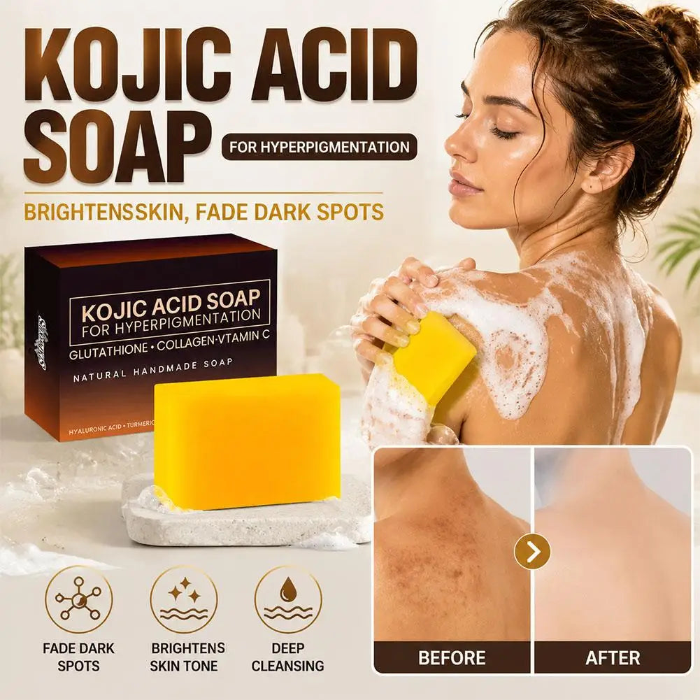 Pure Kojic Acid & Turmeric Soap Bar 100g,Skin Brightening Bar for Face & Body, Helps Improve Uneven Skin Tone, Dark Spots & Acne