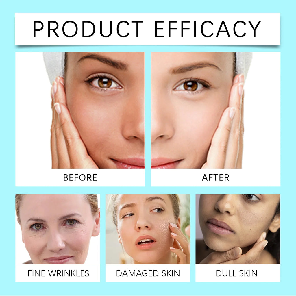 HOYGI Face Soothing Spray Hyaluronic Acid Toner Skin Care Deep Hydration Moisturizing Facial Mist Nourishing Relieve Redness
