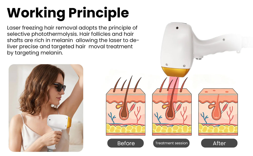 Professional 808nm diode hair removal machinePermanent Hair Removal equipment, Private and Painless Full body Hair Removal