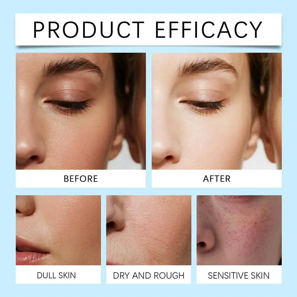 90ML Niacinamide Face Serum Brightening Deep Hydration, Pore Minimizer & Dark Spot Corrector with Hyaluronic Acid & Vitamin E
