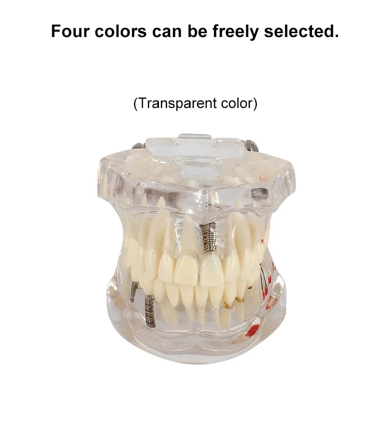 VVDental Teeth Repair Model Disease Teeth Model for Dentist Student Practice Training Studying Oral Medical Dentistry Tools