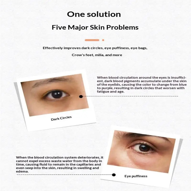 4 In 1 Electric Facial Massager Micro Vibration Eye Beauty Instrument For Relax Eye Dark Circles Eye Bags Puffiness Eye Massage