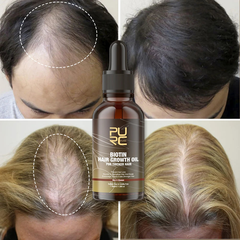 PURC Smoothing Hair Scalp Treatment Hair Shampoo Biotin Hair Oil and Conditioner Set for Men Women Hair Care