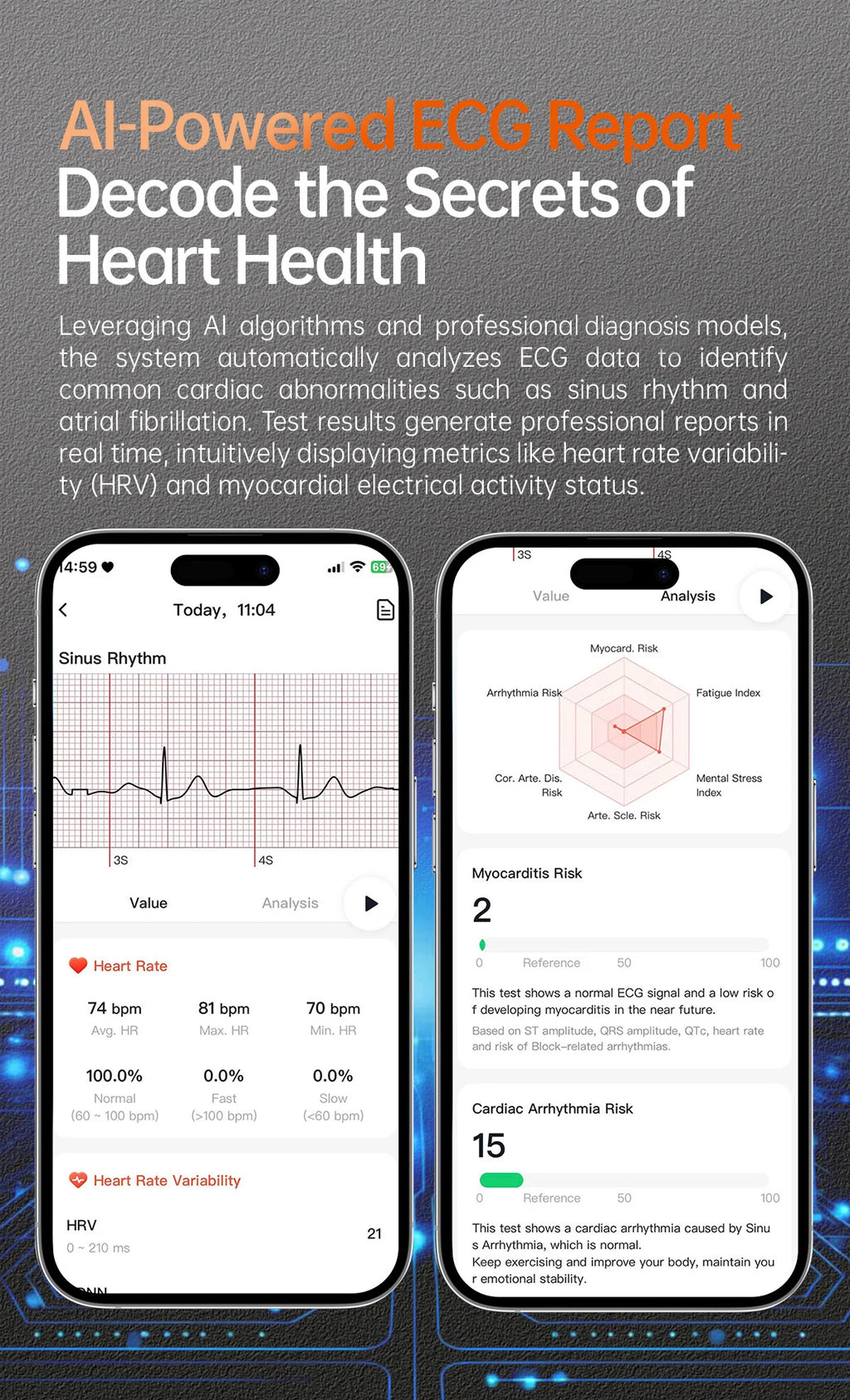 2025 New NFC+ECG+PPG Health Smart Watch BMI Fat Heart Rate Blood Pressure Watch 380mAh BT Call IP68 Waterproof Sports Bracelet