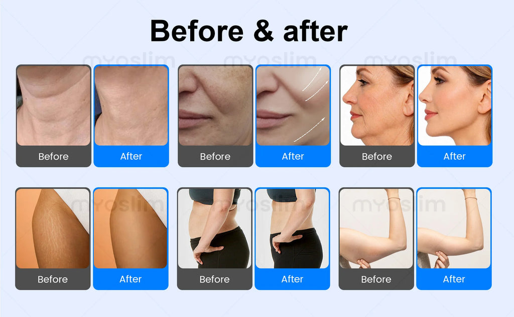 Latest Tecar 448k Body Slimming Machine Skin Tightening Smooth Wrinkles Face Equipment Massage Weight Lose Beauty Machine
