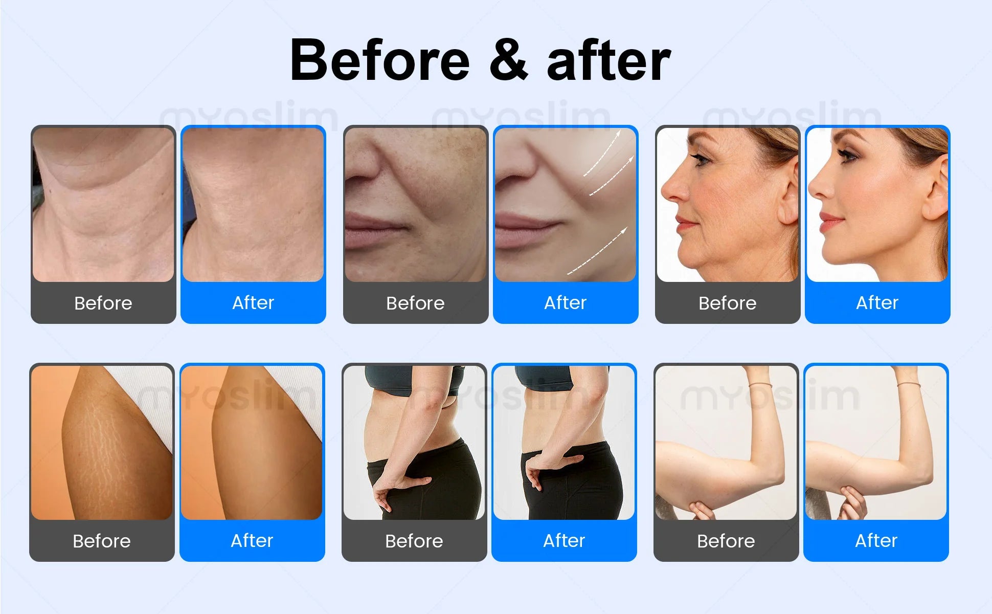 Latest Tecar 448k Body Slimming Machine Skin Tightening Smooth Wrinkles Face Equipment Massage Weight Lose Beauty Machine