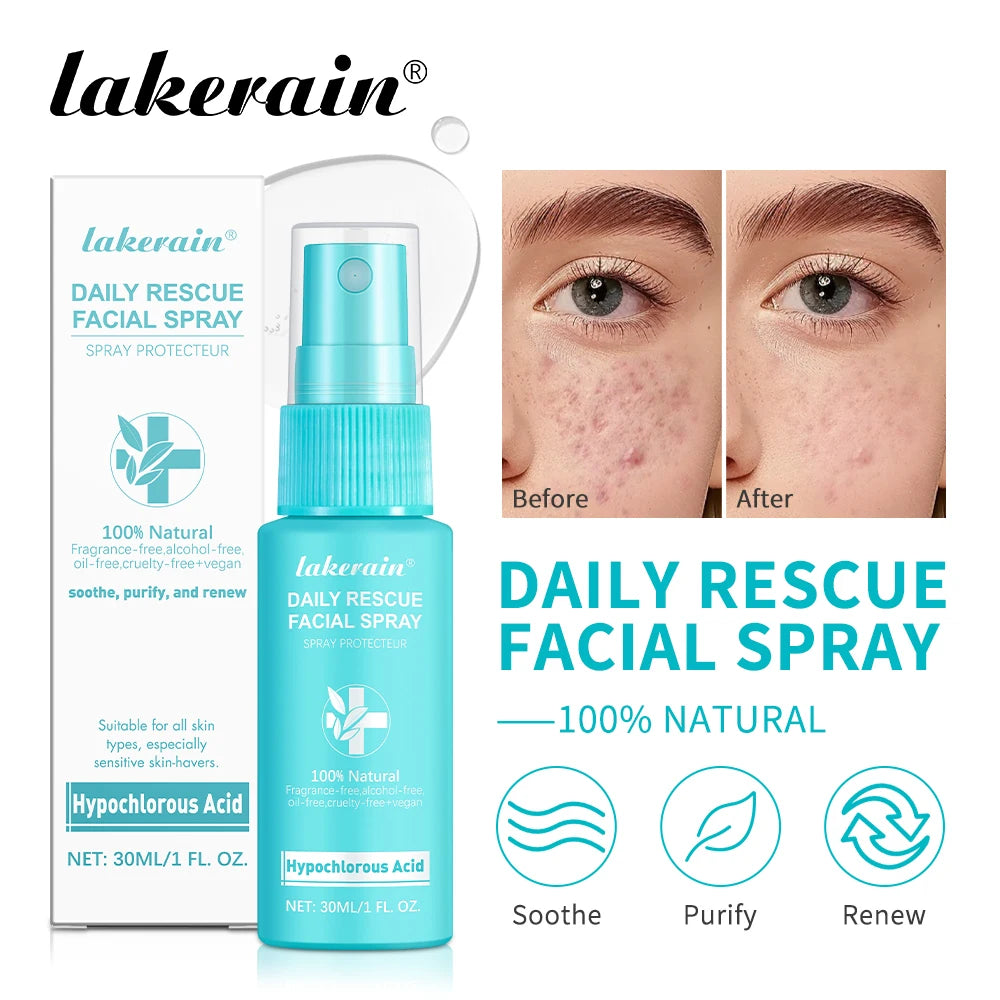 Calming Rescue Facial Spray For Sensitive Skin Hypochlorous Acid Spray Helps Reduce Redness Breakouts Soothing Balancing Spray