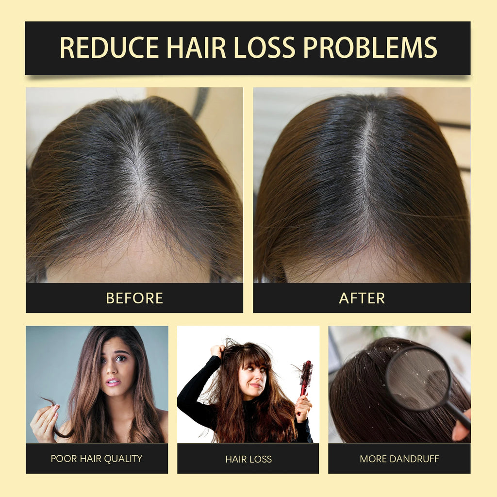 Ginseng Hair Shampoo Clean Scalp Improve Hair Quality Refreshing Oil Control Anti Dandruff Reduce Hair Loss Ginseng Shampoo