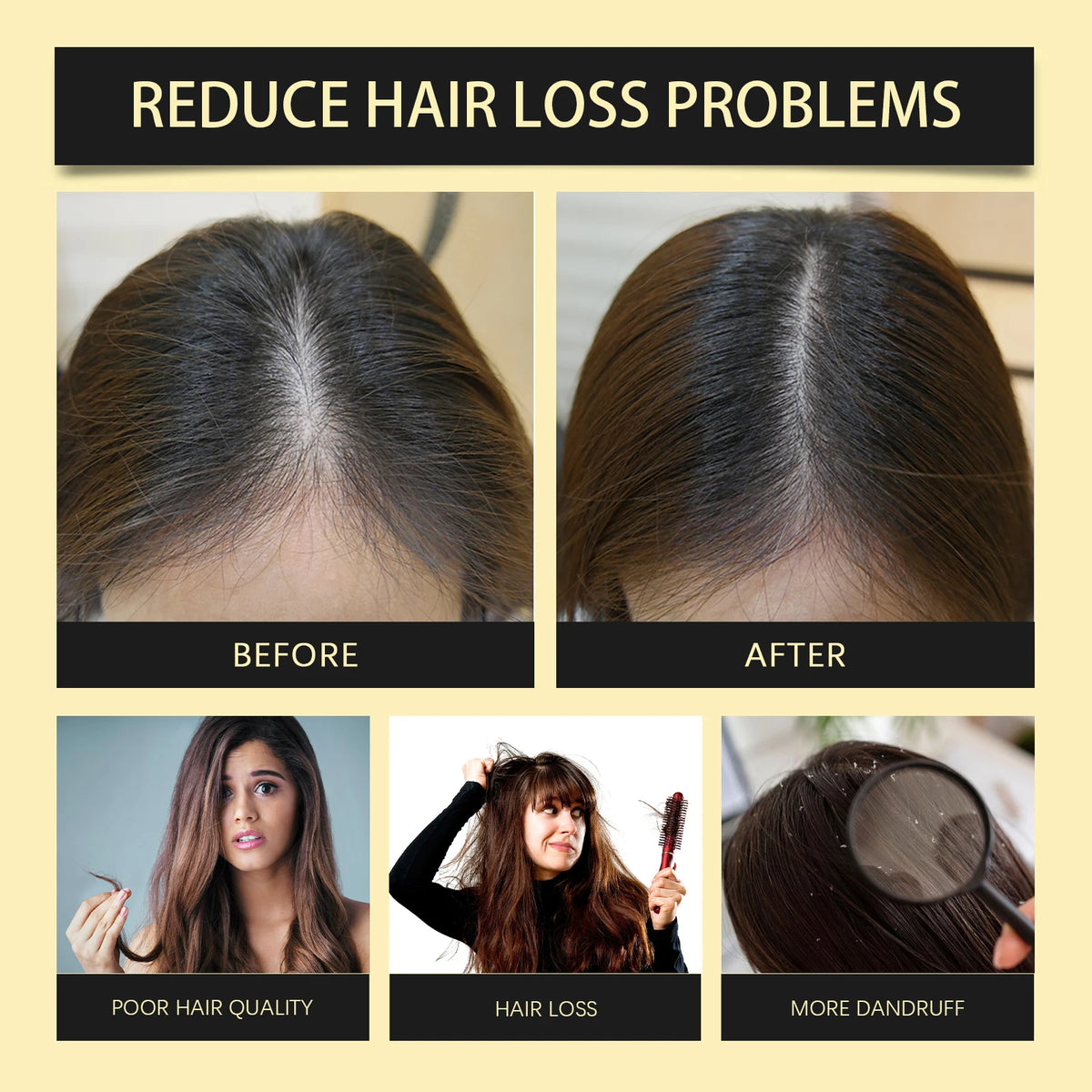 Ginseng Hair Shampoo Clean Scalp Improve Hair Quality Refreshing Oil Control Anti Dandruff Reduce Hair Loss Ginseng Shampoo