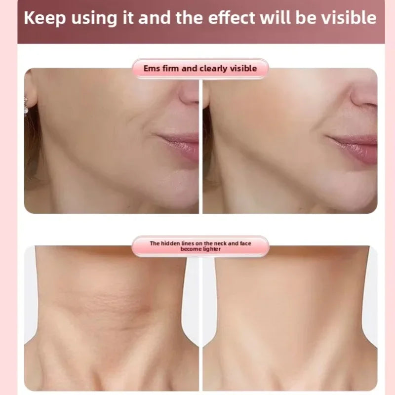 Roller Face-Slimming Artifact V-Face Beauty Facial Massager For Firming And Lifting The Face