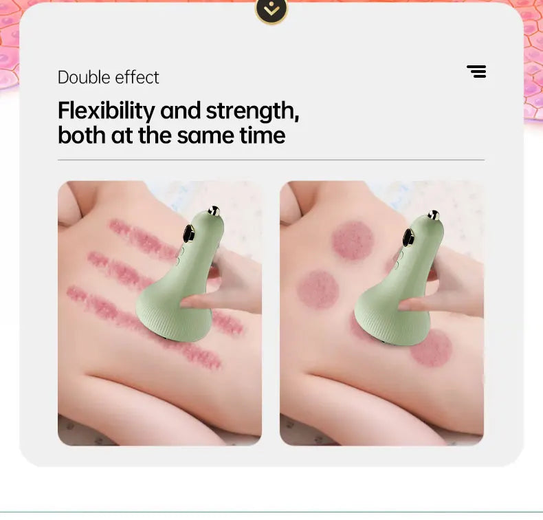 Electric Cupping Massager Vacuum Suction Cup Electric Vacuum Cupping Beauty Health Scraping Infrared Heat Body Slimming Massage