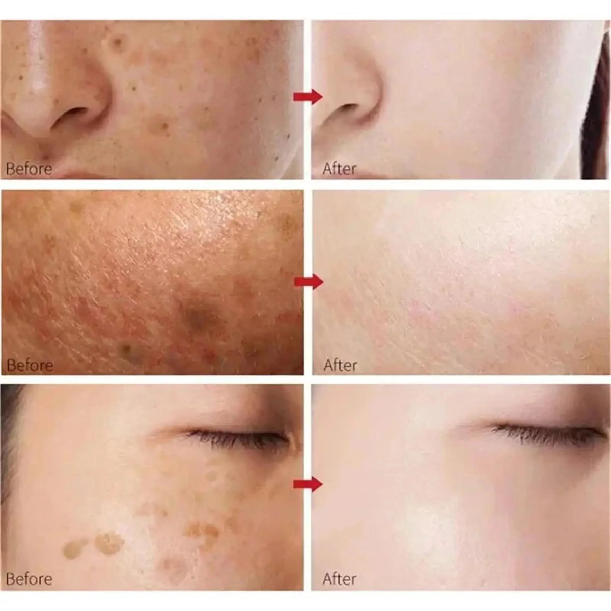 Vitamin C Whitening Serum Face Remove Dark Spots Freckles Fade Melanin Retinol Anti-wrinkle Essence Brightening Korean Skin Care