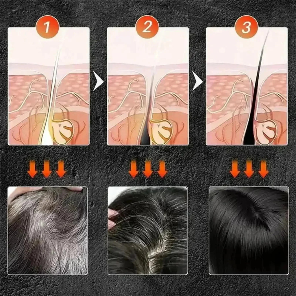 Herbal Anti-grey Hair Treatment Serum Cream White To Black Permanent Repair Natural Color Nourish Scalp Hair Care Products