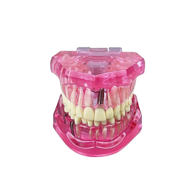 VVDental Teeth Repair Model Disease Teeth Model for Dentist Student Practice Training Studying Oral Medical Dentistry Tools