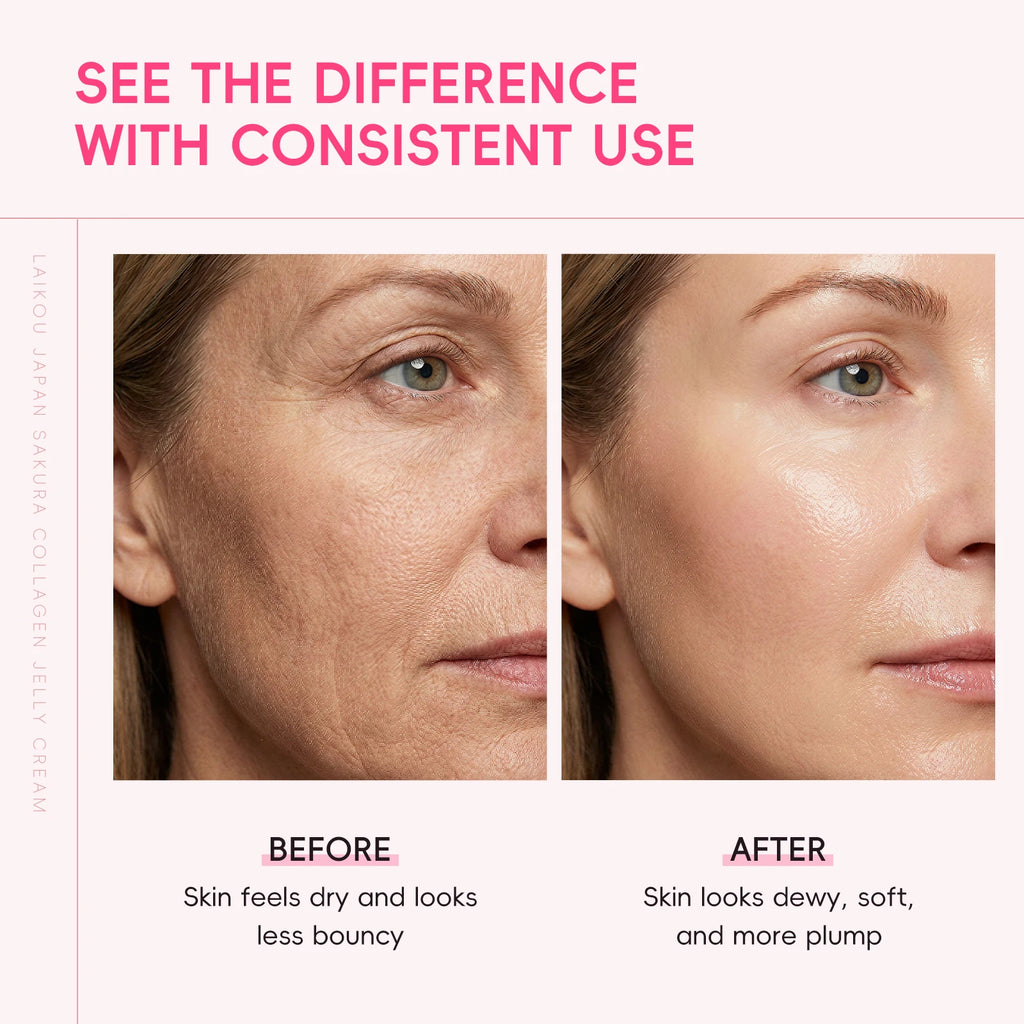 LAIKOU Japan Sakura Collagen Jelly Cream 100g Gentle Formula Hydrated Plump Youthful Radiance Glass Glow Skin Care