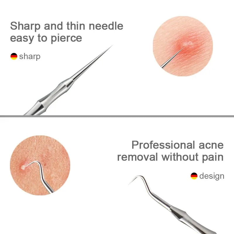 New Acne Needle Kit, Remove Blackheads, Pimples & Closed Comedones
