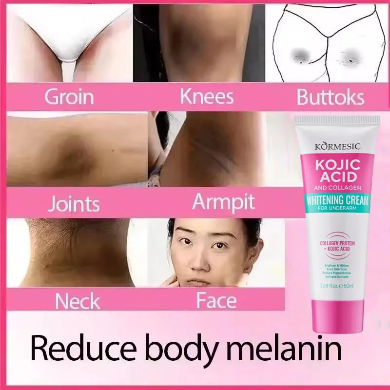 Whitening Cream Private Parts Underarm Bleaching Serum Whiten Butt Knee Brighten Inner Thigh Intimate Parts Dark Remove Melanin