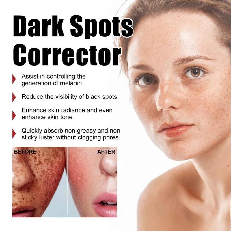 Powerful Spot-Removing Whiten Serum Brighten Skin Fast Eliminates Melanin Pigmentation Melasma Dark Spots Korean Face Skin Care