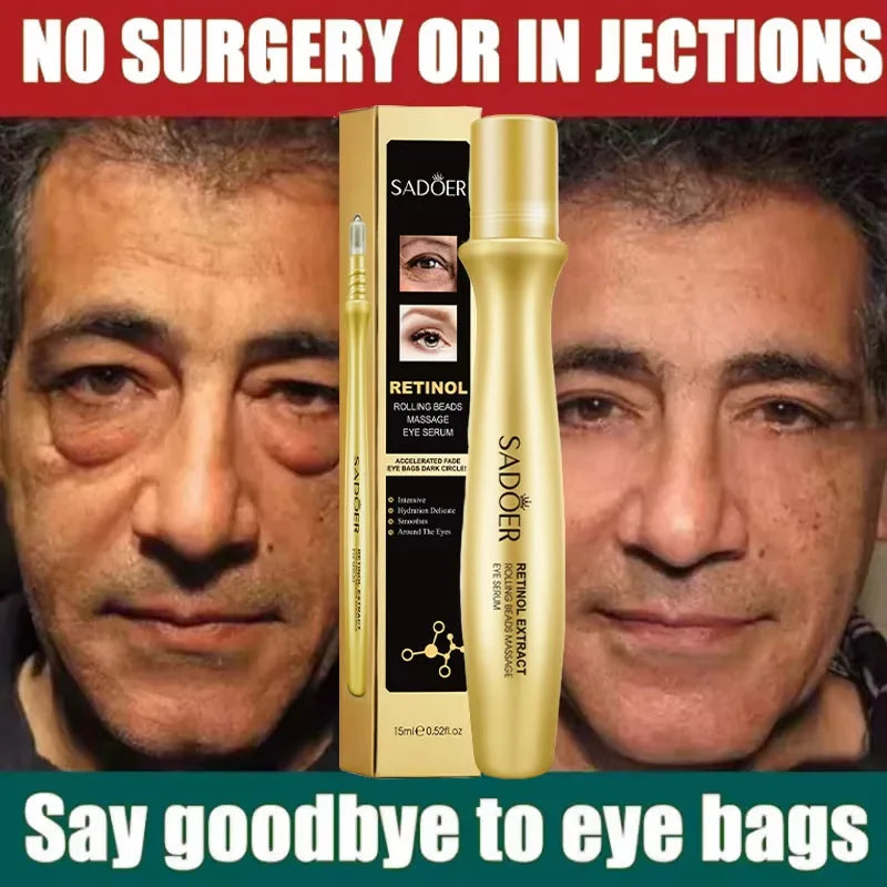 Instant Eye Bag Removal Rolling Beads Massage Serum Retinol Anti-Wrinkle Firm Skin Anti Dark Circle Puffiness Brighten Eye Care