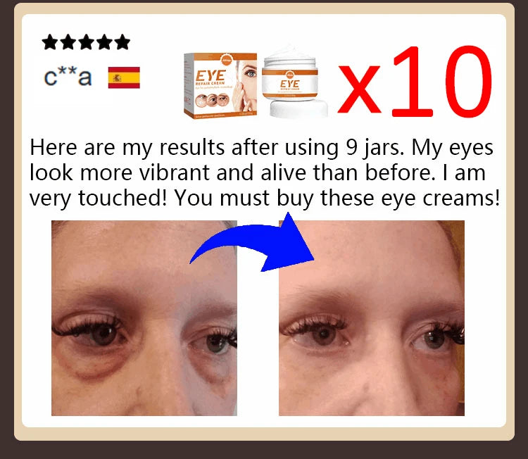 2026 New Upgraded Bestselling Eye Care Tool - Eye Revitalizing Ointment (Free Shipping)